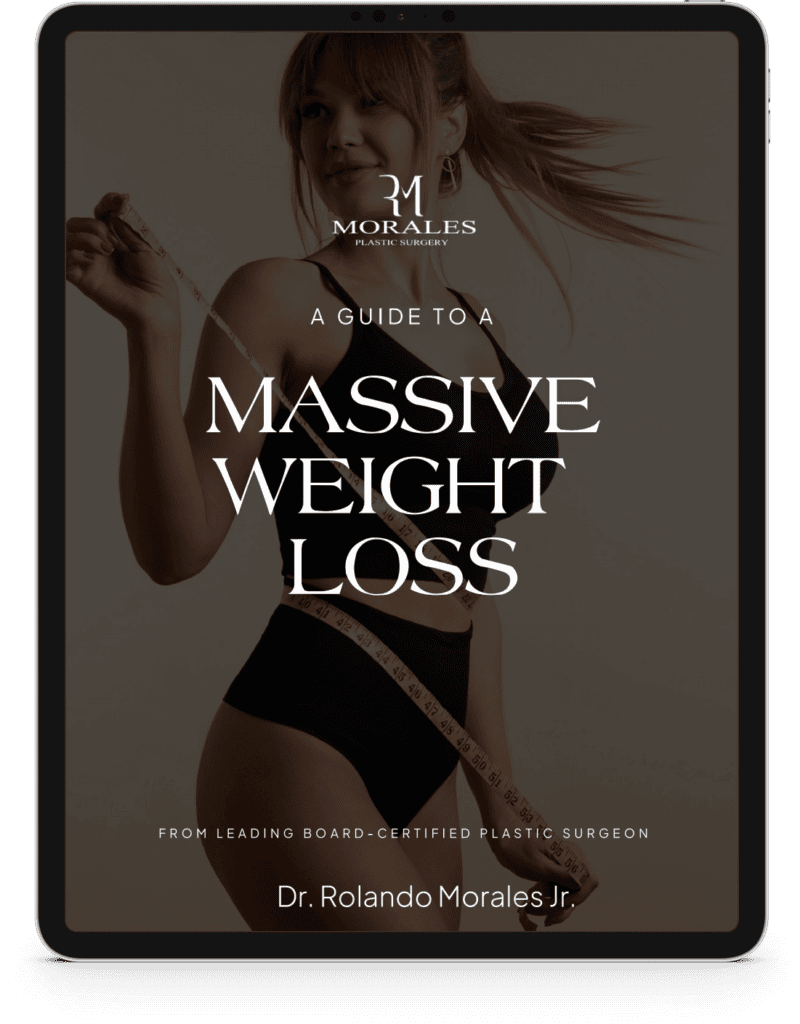 An eBook cover featuring a woman holding a measuring tape, titled "A Guide to a Massive Weight Loss" by Dr. Rolando Morales Jr.