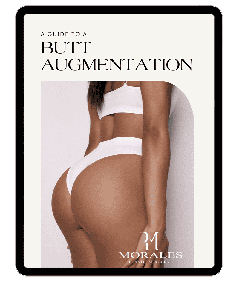 An eBook cover titled "A Guide to Butt Augmentation" featuring a model in white lingerie, showcasing a side view.